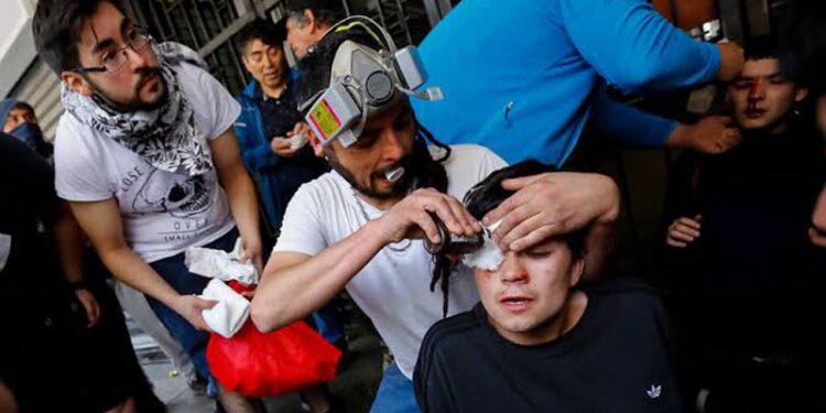 Heridos oculares,priotestas chile. Foto agencias.