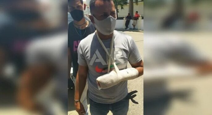 El alcalde del municipio Valdez por el Psuv, , Ander Charles, fue agredido en la mano por un teniente de la Guardia Nacional | Foto: cortesía habitantes de Guiria.