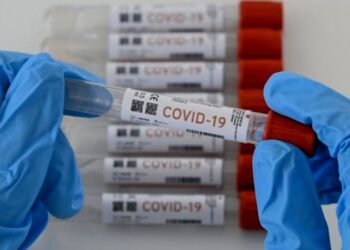 Test Coronavirus. Foto agencias.