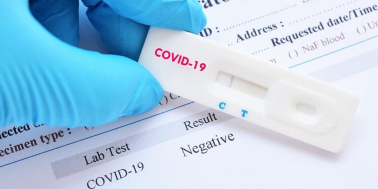Test coronavirus. Foto de archivo.
