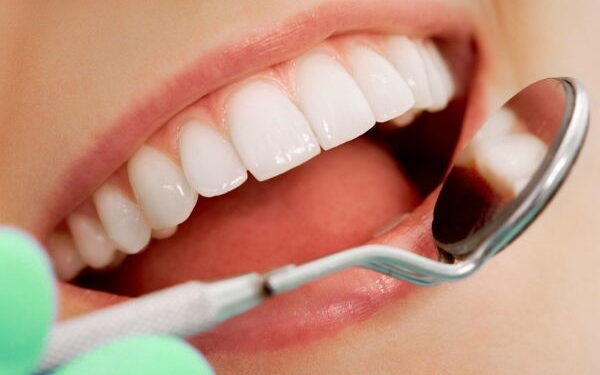 Estética dental.